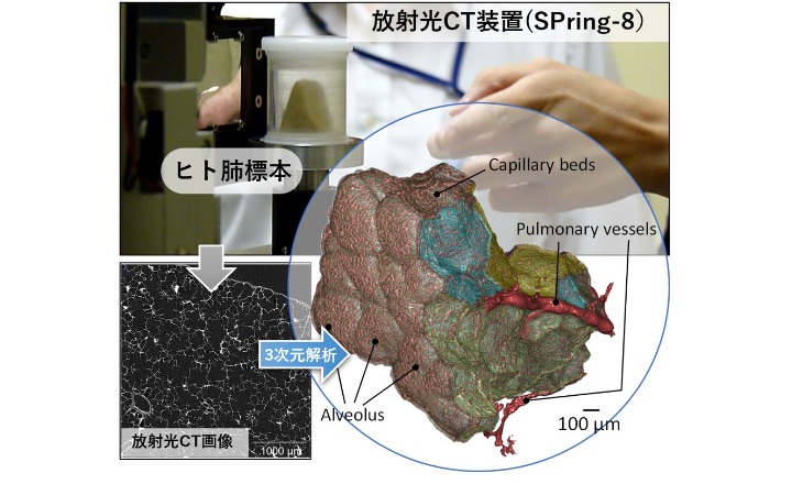 放射光が解き明かす肺のミクロ構造「放射光CTによる肺のミクロ成長と病態の解明」