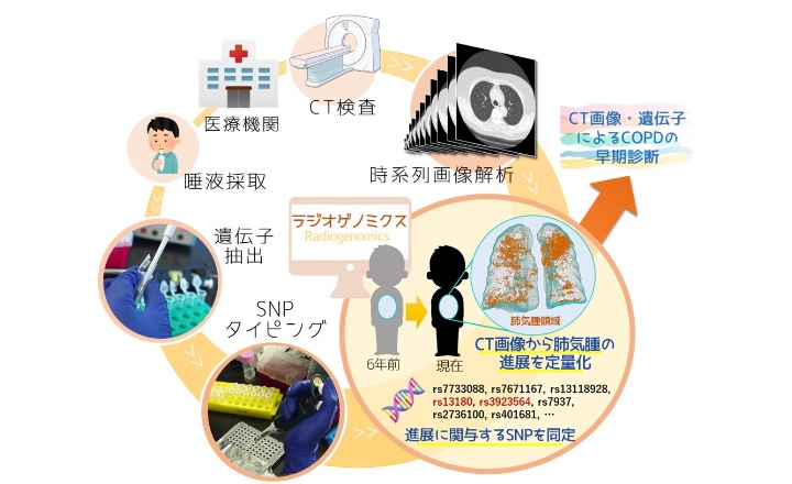 時空間ビッグデータと遺伝子の融合「COPDの長期経年CT画像・遺伝子による統合診断」