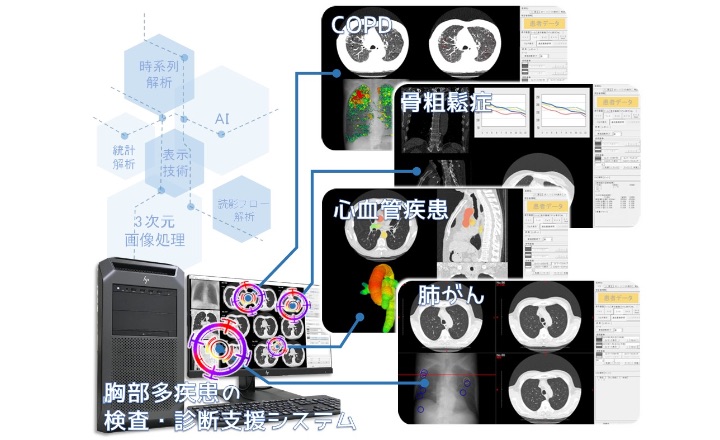 見つける・診るを助ける「胸部多疾患の検査・診断支援システム」